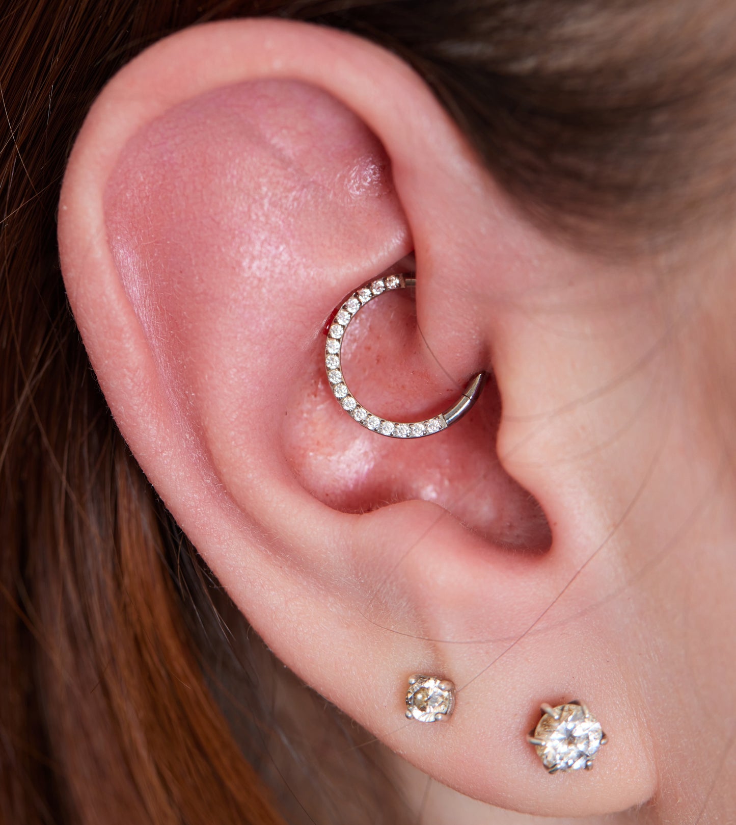 Double Daith
